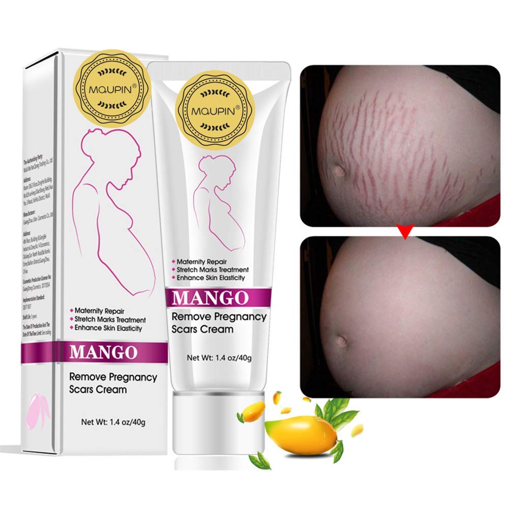 Featured image of post Best Stretch Mark Removal Cream